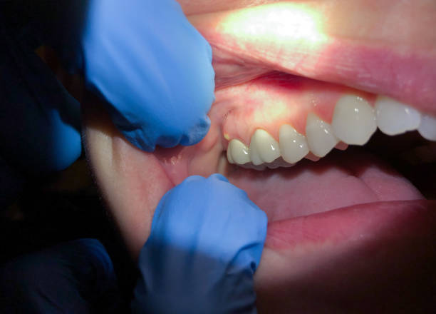Best Cracked Tooth Emergency Dentist  in Fords, NJ