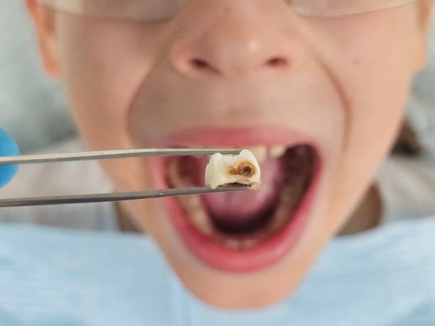 Best Root Canal Emergency Dentist  in Fords, NJ